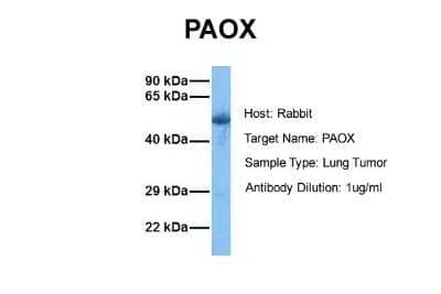 Western Blot: PAOX Antibody [NBP1-70668]