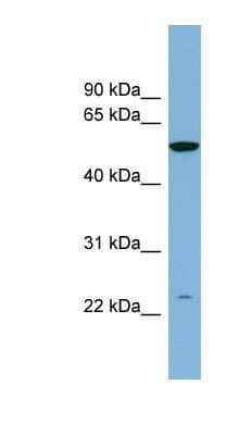 Western Blot: PAOX Antibody [NBP1-70669]