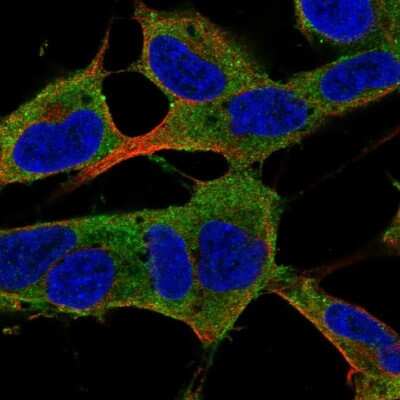 Immunocytochemistry/ Immunofluorescence: PAP2 Antibody [NBP2-68748]