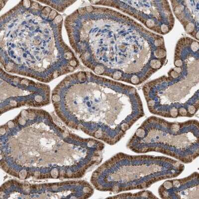 Immunohistochemistry-Paraffin: PAP2 Antibody [NBP1-91086]