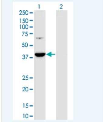 Western Blot: PAP39 Antibody (5H10) [H00005635-M01-100ug]