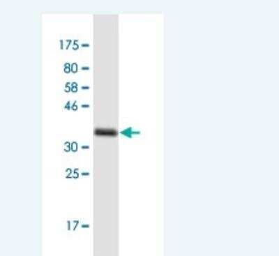 Western Blot: PAP39 Antibody (5H10) [H00005635-M01-100ug]