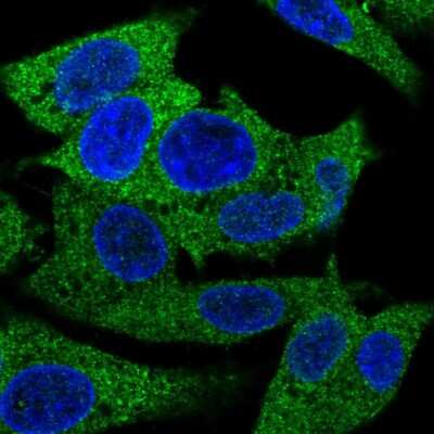 Immunocytochemistry/ Immunofluorescence: PAP39 Antibody [NBP2-55938]