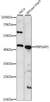 Western Blot: PAP39 AntibodyAzide and BSA Free [NBP2-93395]