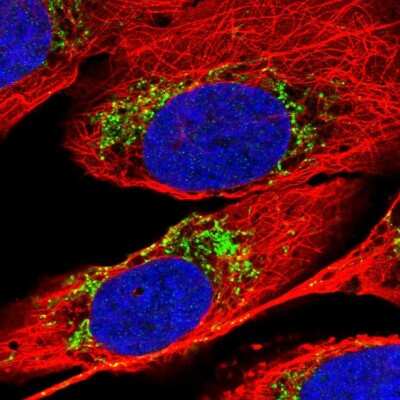 Immunocytochemistry/ Immunofluorescence: PAPD1 Antibody [NBP2-55422]