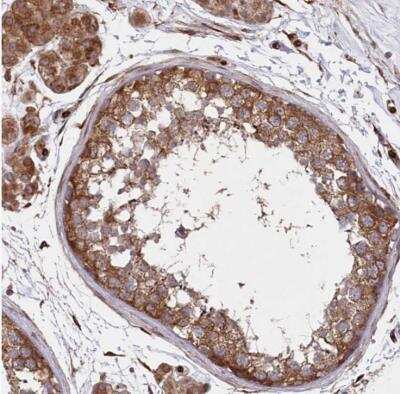 Immunohistochemistry-Paraffin: PAPD1 Antibody [NBP1-83856]