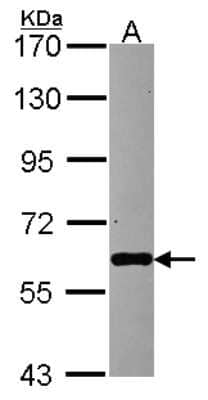 Western Blot: PAPD1 Antibody [NBP2-19689]
