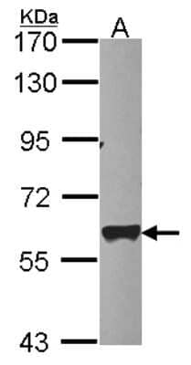 Western Blot: PAPD1 Antibody [NBP2-19690]