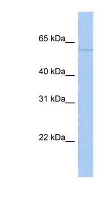 Western Blot: PAPD4 Antibody [NBP1-53057]