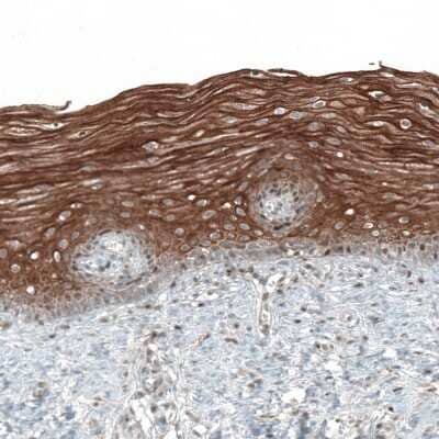 Immunohistochemistry-Paraffin: PAPD5 Antibody [NBP2-48777]