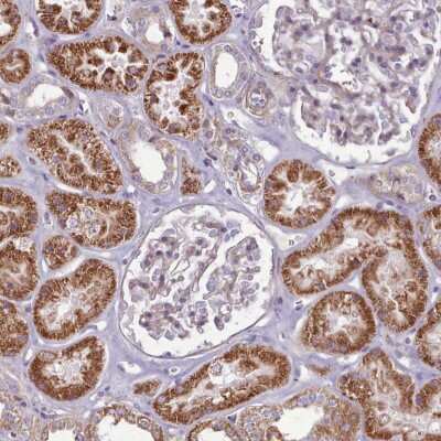 Immunohistochemistry-Paraffin: PAPD5 Antibody [NBP2-48896]