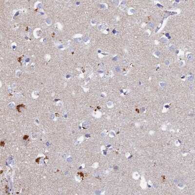 Immunohistochemistry: PAPL Antibody [NBP2-48768]