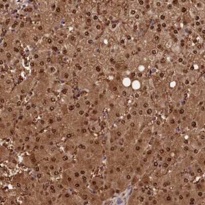 Immunohistochemistry-Paraffin: PAPL Antibody [NBP2-48753]