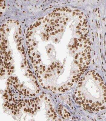 Immunohistochemistry-Paraffin: PAPOLA Antibody [NBP1-87345]