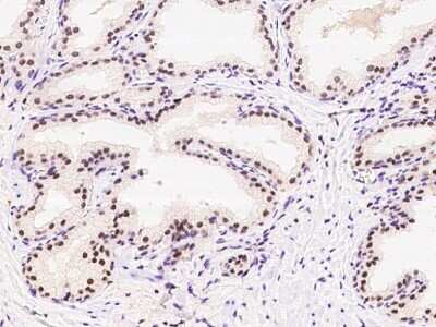 Immunohistochemistry-Paraffin: PAPOLA Antibody [NBP2-97833]