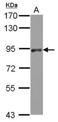 Western Blot: PAPOLA Antibody [NBP2-19691]