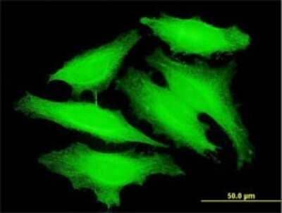 Immunocytochemistry/ Immunofluorescence: PAPOLB Antibody (3D7) [H00056903-M01]