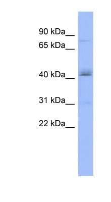 Western Blot: PAPOLB Antibody [NBP1-57561]