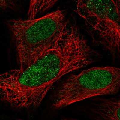 Immunocytochemistry/ Immunofluorescence: PAPOLG Antibody [NBP2-55534]