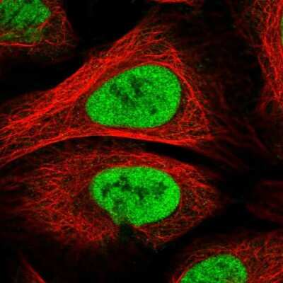 Immunocytochemistry/ Immunofluorescence: PAPOLG Antibody [NBP2-55535]