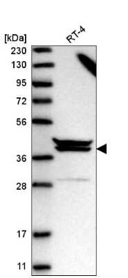 Western Blot: PAPOLG Antibody [NBP2-55534]