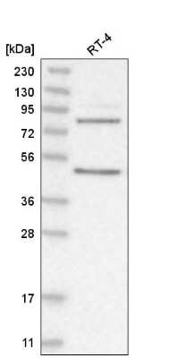 Western Blot: PAPOLG Antibody [NBP2-55535]