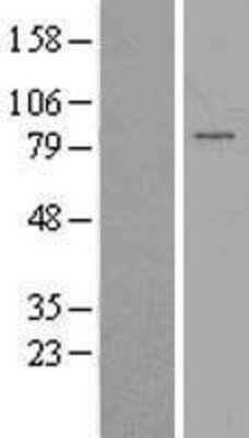 Western Blot: PAPOLG Overexpression Lysate [NBP2-06380]