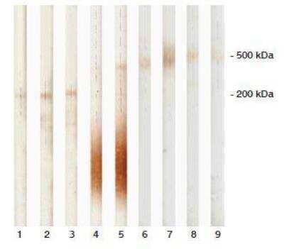 Western Blot: Pappalysin-1/PAPP-A Antibody (10E1cc) [NB120-8346]