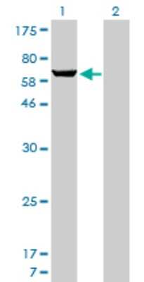 Western Blot: PAPSS1 Antibody (1F4) [H00009061-M05]