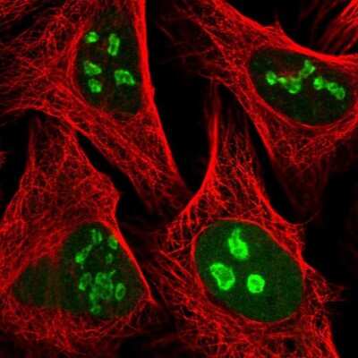 Immunocytochemistry/ Immunofluorescence: PAPSS1 Antibody [NBP2-13730]