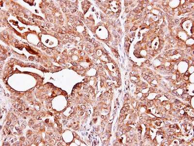 Immunohistochemistry-Paraffin: PAPSS1 Antibody [NBP1-33470]