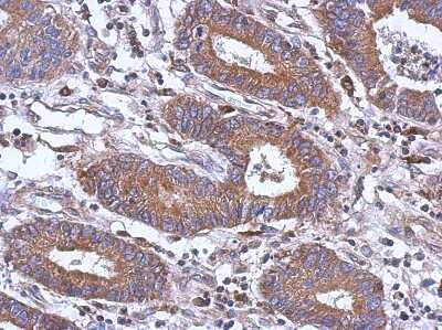 Immunohistochemistry-Paraffin: PAPSS1 Antibody [NBP2-19692]