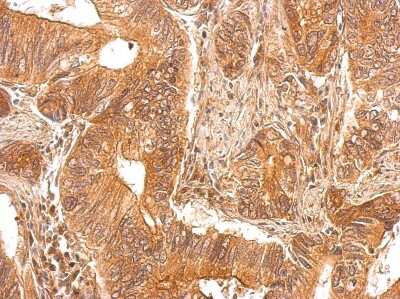 Immunohistochemistry-Paraffin: PAPSS1 Antibody [NBP2-19692]
