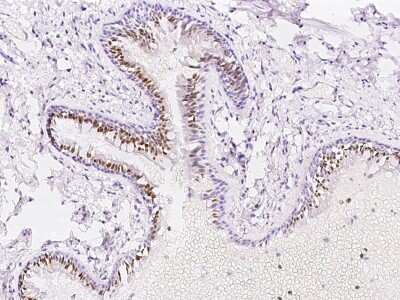 Immunohistochemistry-Paraffin: PAPSS1 Antibody [NBP2-97681]