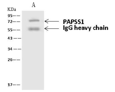 Immunoprecipitation: PAPSS1 Antibody [NBP2-97681]