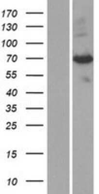 Western Blot: PAPSS1 Overexpression Lysate [NBP2-07749]