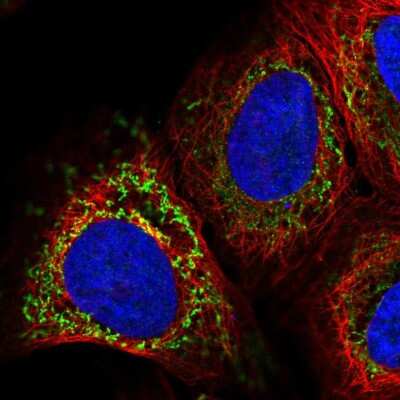 Immunocytochemistry/ Immunofluorescence: PAPSS2 Antibody [NBP2-56643]