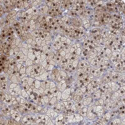 Immunohistochemistry-Paraffin: PAPSS2 Antibody [NBP3-17062]