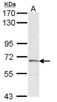 Western Blot: PAPSS2 Antibody [NBP1-33726]