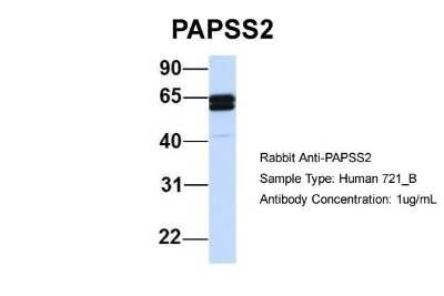 Western Blot: PAPSS2 Antibody [NBP1-55135]