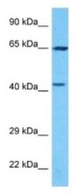 Western Blot: PAPSS2 Antibody [NBP3-09946]