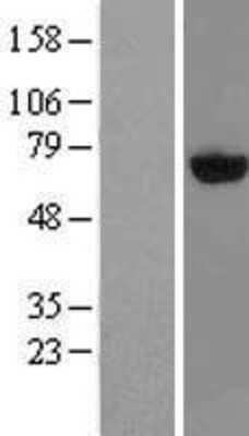 Western Blot: PAPSS2 Overexpression Lysate [NBL1-14096]