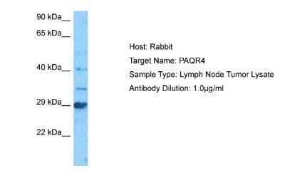 Western Blot: PAQR4 Antibody [NBP2-83356]