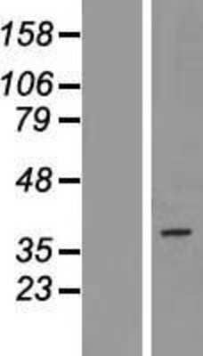 Western Blot: PAQR5 Overexpression Lysate [NBL1-14098]