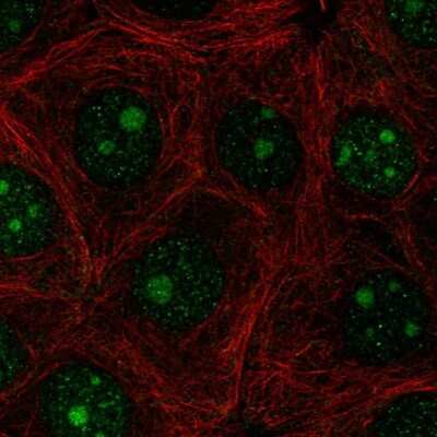 Immunocytochemistry/ Immunofluorescence: PAQR6 Antibody [NBP2-57962]