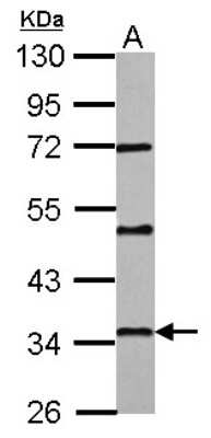 Western Blot: PAQR6 Antibody [NBP2-19694]