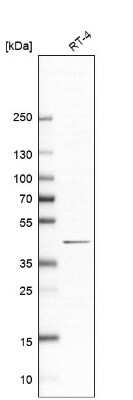 Western Blot: PAQR6 Antibody [NBP2-57962]
