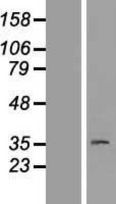 Western Blot: PAQR8 Overexpression Lysate [NBL1-14101]