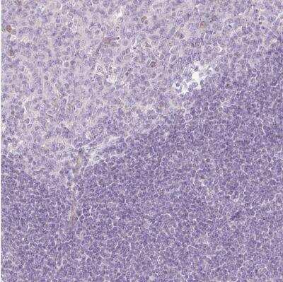 Immunohistochemistry-Paraffin: PAQR9 Antibody [NBP2-30402]