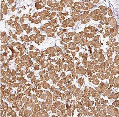 Immunohistochemistry-Paraffin: PAQR9 Antibody [NBP2-30402]